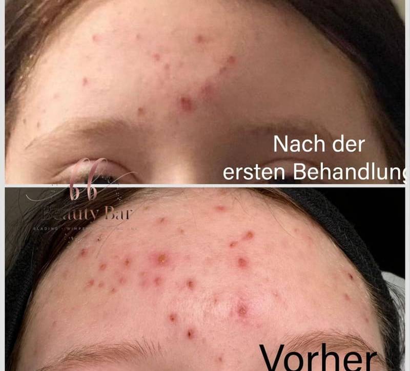 gesichtsbehandlungsservice-beauty-bar-ffo-2