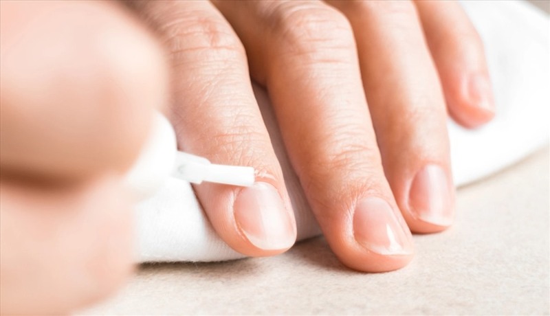 nagelreparatur-nach-dem-entfernen-von-gel-2